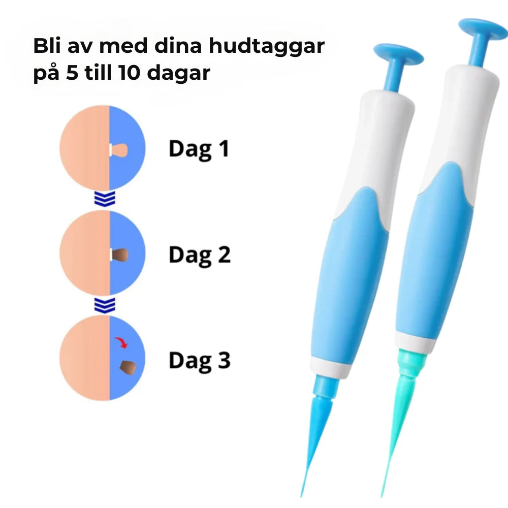 HudRen™penn | Säker borttagning av hudmärken!