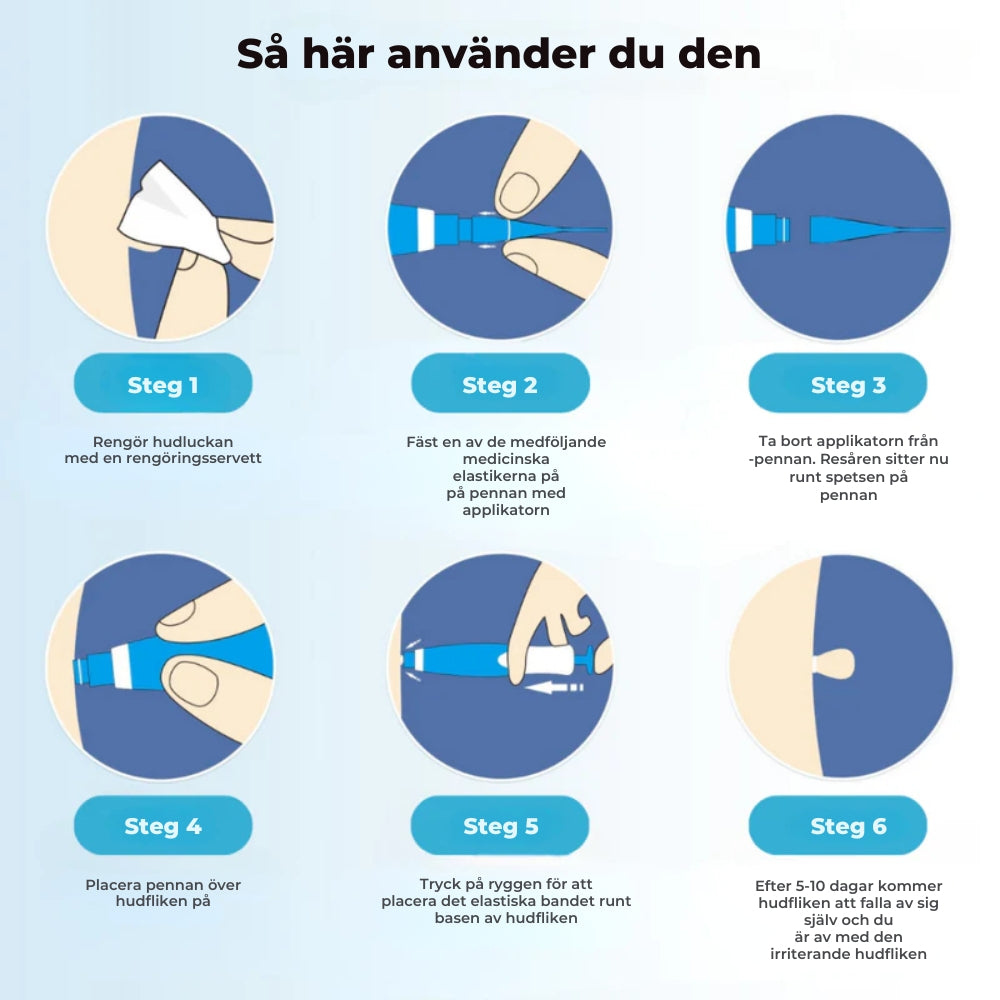 HudRen™penn | Säker borttagning av hudmärken!
