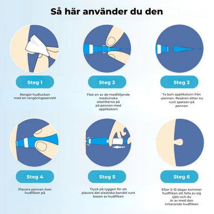 HudRen™penn | Säker borttagning av hudmärken!